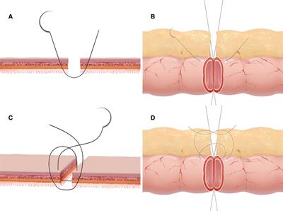 An alternative asymmetric figure-of-eight single-layer suture technique for bowel anastomosis in an in vitro porcine model